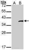 Anti-TFB2M antibody [C3], C-term used in Western Blot (WB). GTX107714