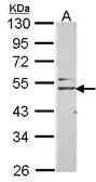 Anti-Nogo Receptor antibody [N2N3] used in Western Blot (WB). GTX107717