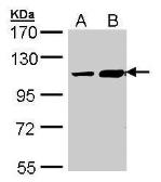 Anti-TRAK2 antibody [C3], C-term used in Western Blot (WB). GTX107718