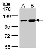 Anti-TRAK2 antibody [C3], C-term used in Western Blot (WB). GTX107718