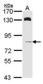 Anti-HPS6 antibody [C1], Internal used in Western Blot (WB). GTX107720