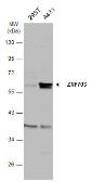 Anti-ZNF703 antibody used in Western Blot (WB). GTX107721
