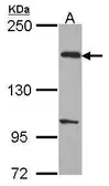 Anti-EVC2 antibody [C3], C-term used in Western Blot (WB). GTX107725