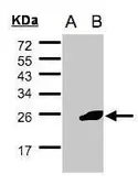 Anti-NCE2 antibody [C1C3] used in Western Blot (WB). GTX107726