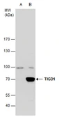Anti-TIGD1 antibody [C3], C-term used in Western Blot (WB). GTX107727