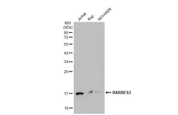 Anti-RARRES3 antibody [N3C3] used in Western Blot (WB). GTX107735