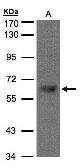 Anti-TBL1X antibody [C3], C-term used in Western Blot (WB). GTX107736