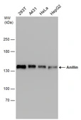 Anti-Anillin antibody [C3], C-term used in Western Blot (WB). GTX107742