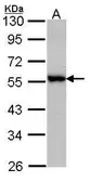 Anti-DOK3 antibody [C3], C-term used in Western Blot (WB). GTX107744