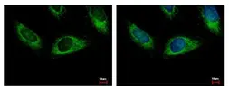 Anti-HPS3 antibody [C3], C-term used in Immunocytochemistry/ Immunofluorescence (ICC/IF). GTX107745