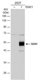 Anti-SGK1 antibody used in Western Blot (WB). GTX107750