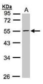 Anti-PFKFB4 antibody used in Western Blot (WB). GTX107755