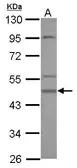 Anti-Casein Kinase 1 gamma 2 antibody [N3C3] used in Western Blot (WB). GTX107762