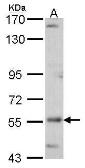 Anti-ADCK4 antibody [N3C3] used in Western Blot (WB). GTX107778