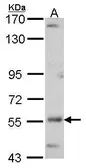 Anti-ADCK4 antibody [N3C3] used in Western Blot (WB). GTX107778