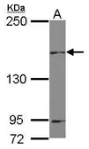 Anti-MAP4K6 antibody [C2C3], C-term used in Western Blot (WB). GTX107788