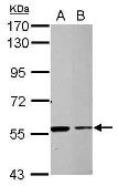 Anti-TRIM27 antibody used in Western Blot (WB). GTX107805