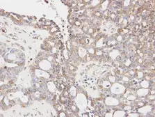 Anti-GLYCTK antibody [N3C3] used in IHC (Paraffin sections) (IHC-P). GTX107807