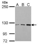Anti-TIE1 antibody used in Western Blot (WB). GTX107818