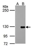 Anti-TIE1 antibody used in Western Blot (WB). GTX107818