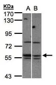 Anti-MST3 antibody [N3C3-2] used in Western Blot (WB). GTX107834