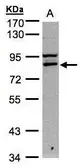 Anti-FASTKD1 antibody [C1C3] used in Western Blot (WB). GTX107835