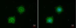Anti-PINK1 antibody [N3C3] used in Immunocytochemistry/ Immunofluorescence (ICC/IF). GTX107851