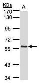 Anti-PINK1 antibody [N3C3] used in Western Blot (WB). GTX107851
