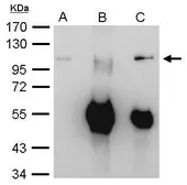 Anti-EXOSC10 antibody used in Immunoprecipitation (IP). GTX107856