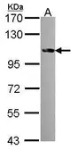 Anti-FES antibody [C1C3] used in Western Blot (WB). GTX107866