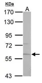Anti-Pyruvate Kinase (liver/RBC) antibody used in Western Blot (WB). GTX107873