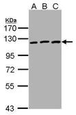 Anti-EphB3 antibody [C1C3] used in Western Blot (WB). GTX107882