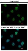 Anti-IP6K2 antibody used in Immunocytochemistry/ Immunofluorescence (ICC/IF). GTX107886