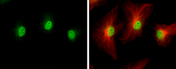 Anti-IP6K2 antibody used in Immunocytochemistry/ Immunofluorescence (ICC/IF). GTX107886