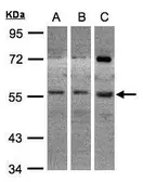 Anti-ADCK1 antibody [N3C3] used in Western Blot (WB). GTX107894
