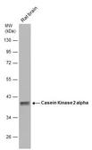 Anti-Casein Kinase 2 alpha antibody used in Western Blot (WB). GTX107897
