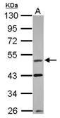 Anti-VRK1 antibody used in Western Blot (WB). GTX107899
