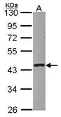 Anti-PSKH1 antibody used in Western Blot (WB). GTX107902
