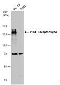 Anti-PDGF Receptor alpha antibody [N2C2], Internal used in Western Blot (WB). GTX107903