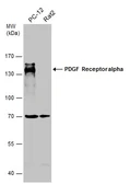 Anti-PDGF Receptor alpha antibody [N2C2], Internal used in Western Blot (WB). GTX107903
