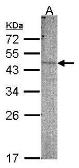 Anti-PI4K2B antibody [N3C3] used in Western Blot (WB). GTX107908