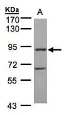 Anti-GRK2 antibody [N3C3-2] used in Western Blot (WB). GTX107915