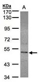 Anti-SEPHS2 antibody [N3C3] used in Western Blot (WB). GTX107917