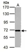 Anti-Nucleoporin p62 antibody used in Western Blot (WB). GTX107920