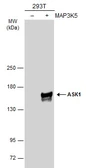 Anti-ASK1 antibody [C2C3-2], C-term used in Western Blot (WB). GTX107921