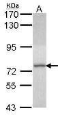 Anti-DDX1 antibody [N3C3] used in Western Blot (WB). GTX107931