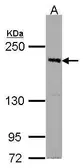 Anti-PASK antibody [C2C3], C-term used in Western Blot (WB). GTX107932