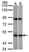 Anti-PRAK antibody [N3C3] used in Western Blot (WB). GTX107938