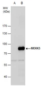 Anti-MEKK3 antibody [N3C3] used in Western Blot (WB). GTX107945