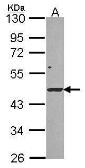 Anti-DRAK1 antibody [N3C3] used in Western Blot (WB). GTX107969